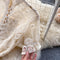 Single-breasted Waist Cutout Lace Dress
